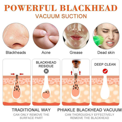Electric Blackhead Remover Vacuum – Multi-Functional Pore Cleaner with 6 Suction Heads | Deep Pore Cleansing & Acne Removal Device